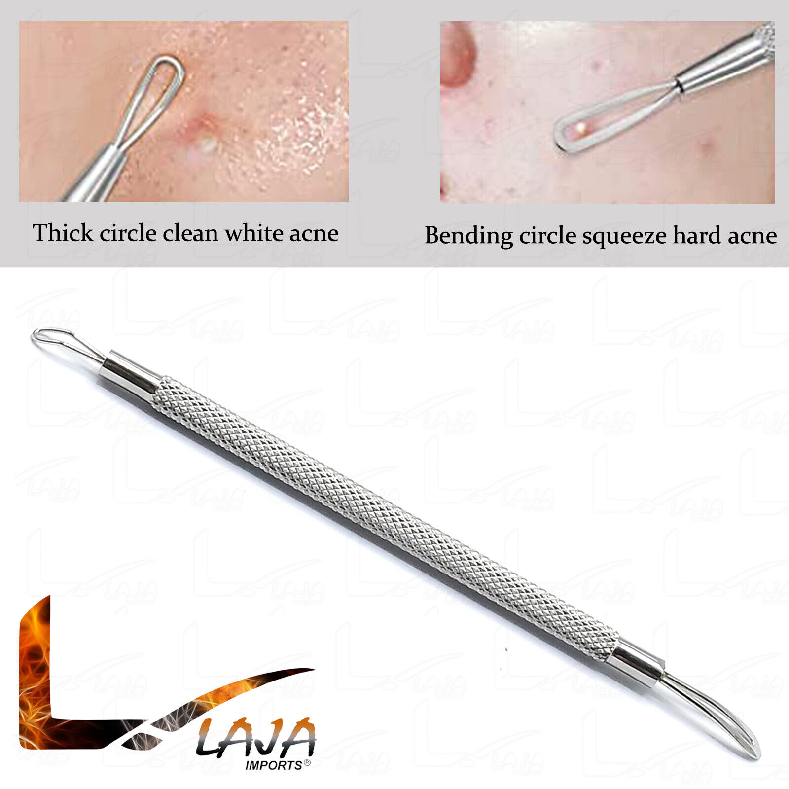 Comedone-Extractor-Blackhead-Remover-Tool-With-Dual-Loop-Stainless-Steel-New-273218200100-3