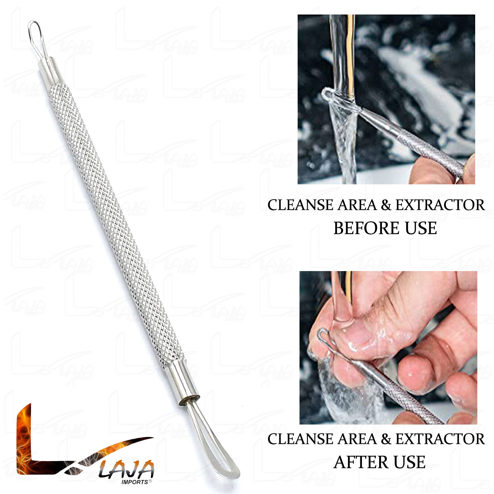 Comedone-Extractor-Blackhead-Remover-Tool-With-Dual-Loop-Stainless-Steel-New-273218200100-4