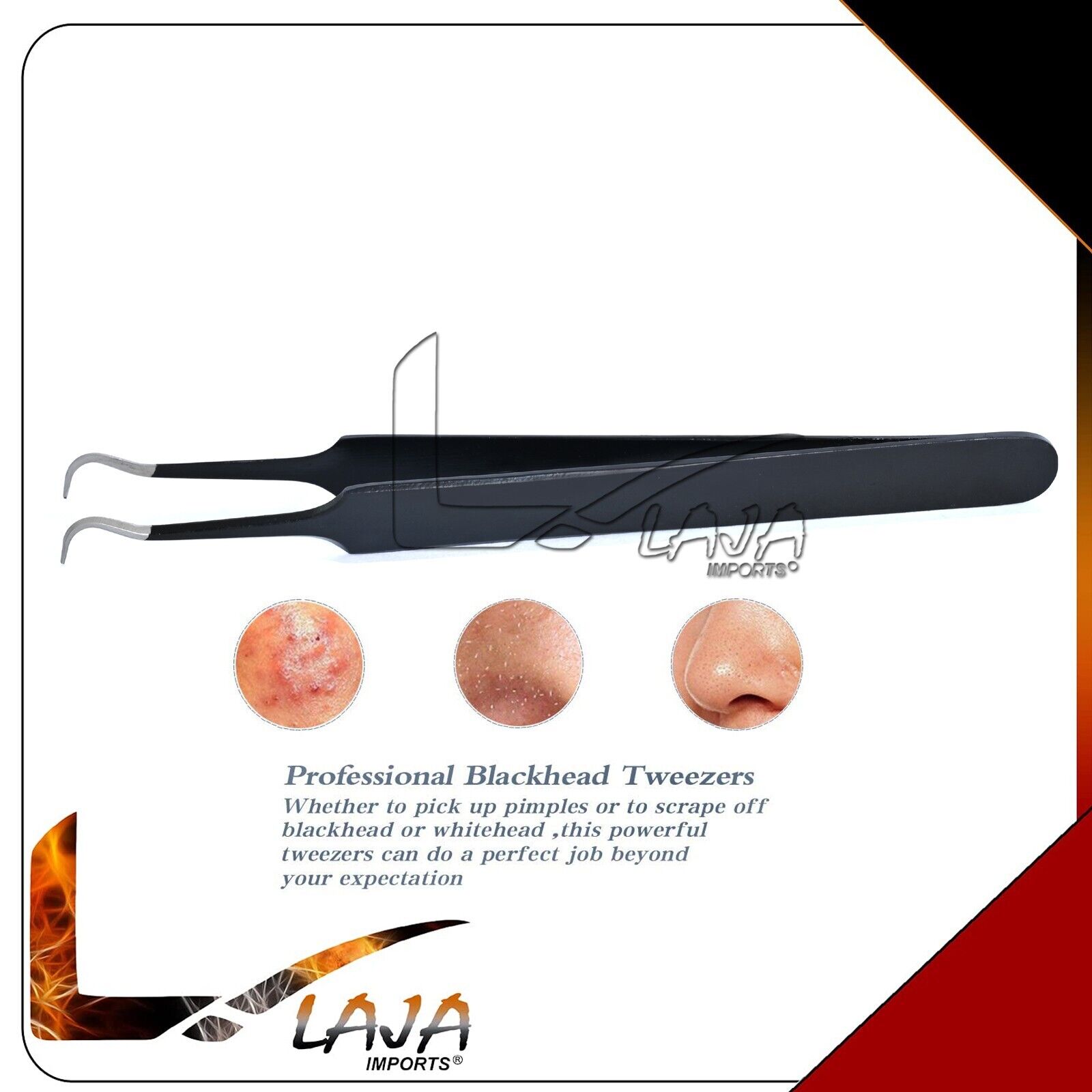 Blackhead-Whitehead-Extractor-Acne-Pimple-Remover-Tweezer-Facial-Care-Tools-276175733493-2